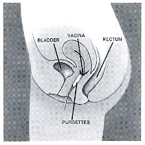 tampon lost vagina Tampon lost vagina