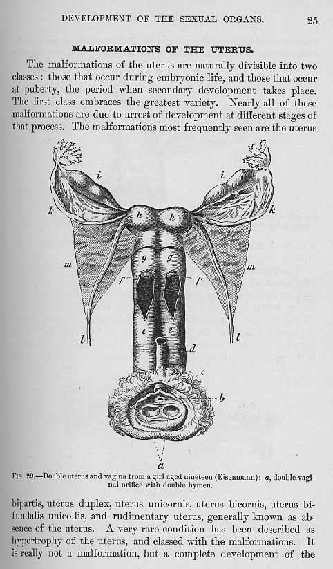 Excerpts from Dr. Alexander Skene's "Diseases of Women" at MUM